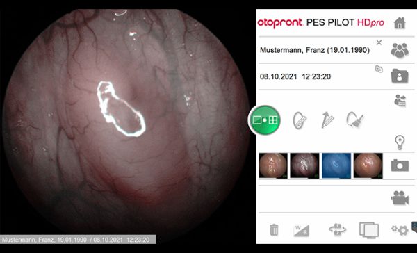 PES PILOT HDpro stroboscope - تصویر 2